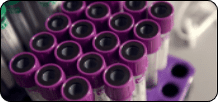 purple test tubes