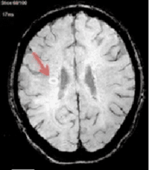 brain MRI image