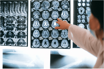MRI results