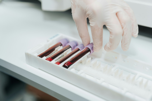 Close up of a lab technician's hand grabbing a vial of blood from a container holding several.
